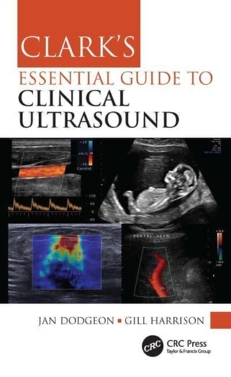 Clark's Essential Guide to Clinical Ultrasound Clark's Essential Guide to Clinical Ultrasound