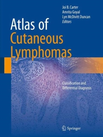 Atlas of Cutaneous Lymphomas Atlas of Cutaneous Lymphomas