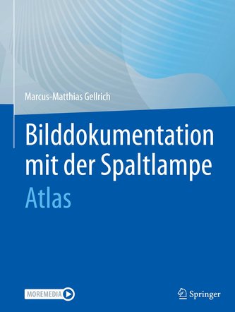 Bilddokumentation mit der Spaltlampe