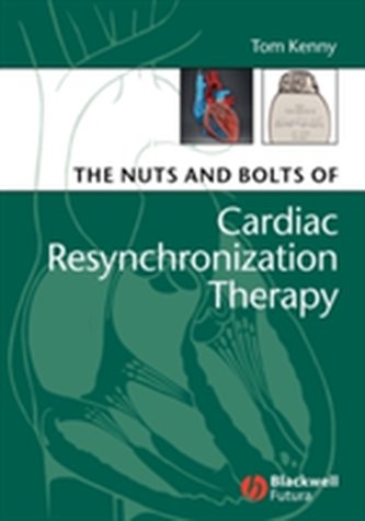 The Nuts and Bolts of Cardiac Resynchronization Therapy The Nuts and Bolts of Cardiac Resynchronization Therapy