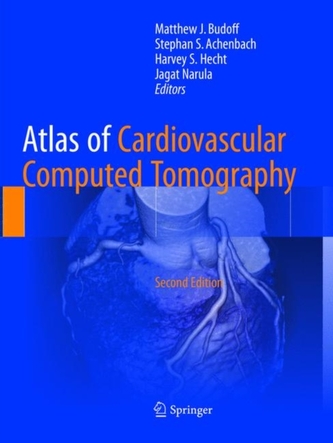 Atlas of Cardiovascular Computed Tomography