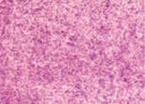 Akvarelová barva DS 15ml – 4050 Iridescent Vibrant Raspberry