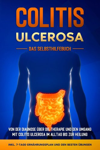 Colitis ulcerosa - Das Selbsthilfebuch: Von der Diagnose über die Therapie und den Umgang mit Colitis ulcerosa im Alltag bis zur