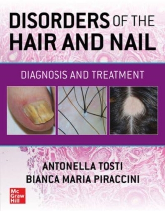 Disorders of the Hair and Nail
