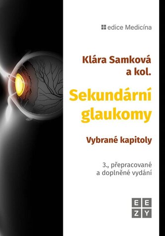 Sekundární glaukomy - Vybrané kapitoly