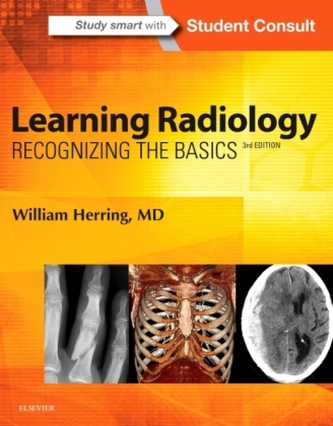 Learning Radiology Learning Radiology