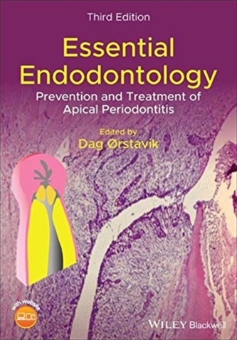 Essential Endodontology