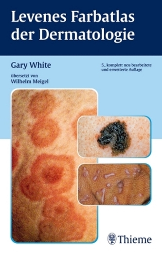 Levenes Farbatlas der Dermatologie