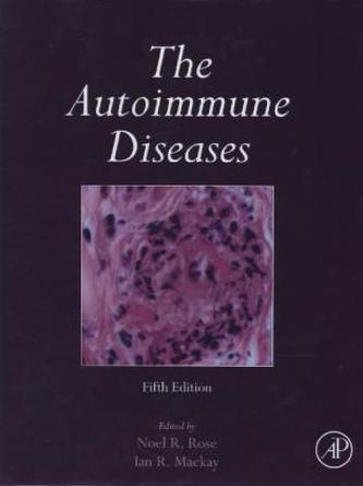 The Autoimmune Diseases