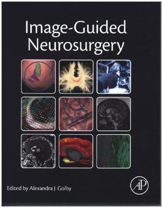 Image-Guided Neurosurgery