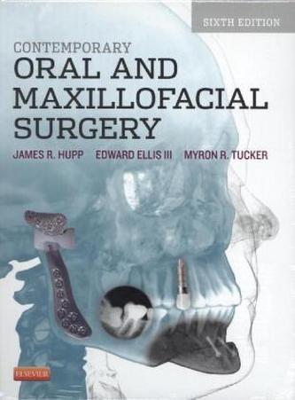 Contemporary Oral and Maxillofacial Surgery