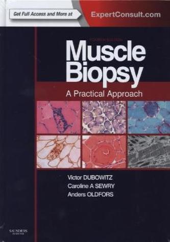 Muscle Biopsy: A Practical Approach