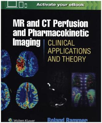 MR & CT Perfusion Imaging: Clinical Applications and Theoretical Principles