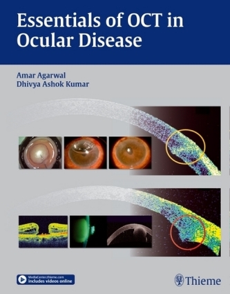 Essentials of OCT in Ocular Disease Essentials of OCT in Ocular Disease