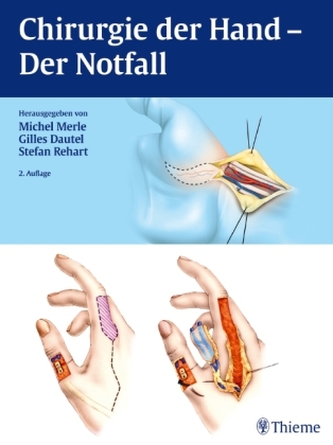 Chirurgie der Hand - Der Notfall