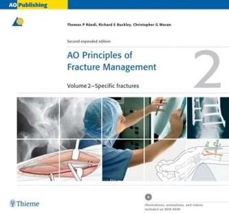 AO Principles of Fracture Management, 2 Vols. w. DVD-ROM