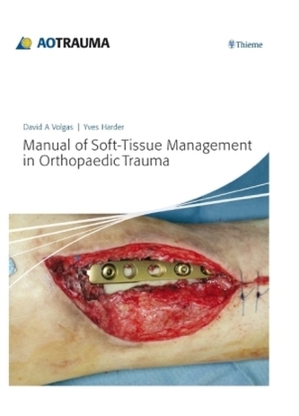 Manual of Soft-tissue Management in Orthopaedic Trauma