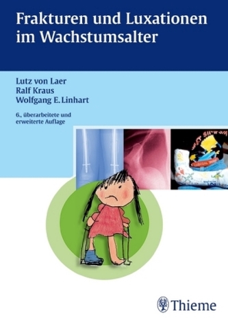 Frakturen und Luxationen im Wachstumsalter