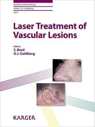 Laser Treatment of Vascular Lesions