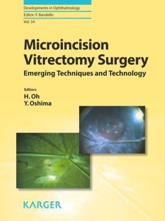Micro-Incision Vitrectomy Surgery