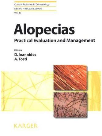 Alopecias - Practical Evaluation and Management