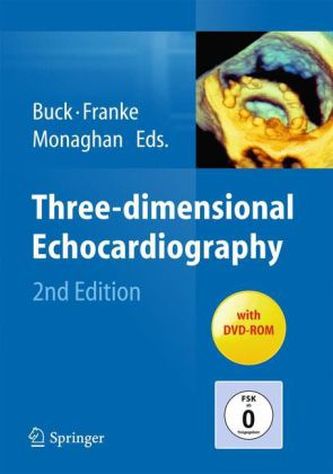 Three-dimensional Echocardiography, w. DVD-ROM