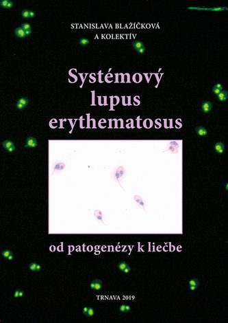 Systémový lupus erythematosus /od patogenézy k liečbe Systémový lupus erythematosus /od patogenézy k liečbe