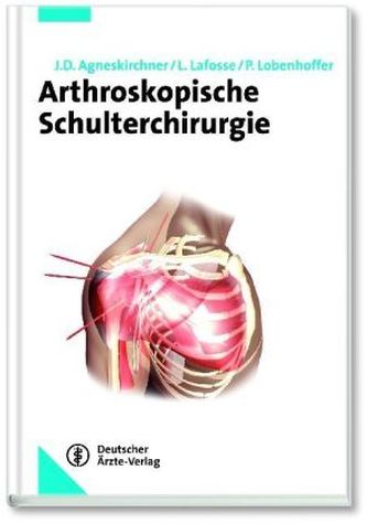 Arthroskopische Schulterchirurgie