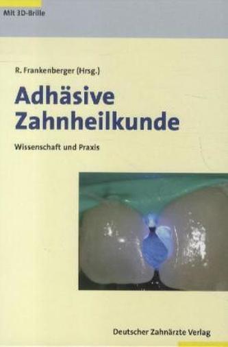 Adhäsive Zahnheilkunde, m. 3D-Brille