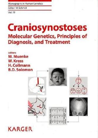 Craniosynostoses