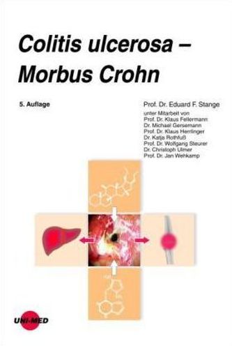 Colitis ulcerosa - Morbus Crohn