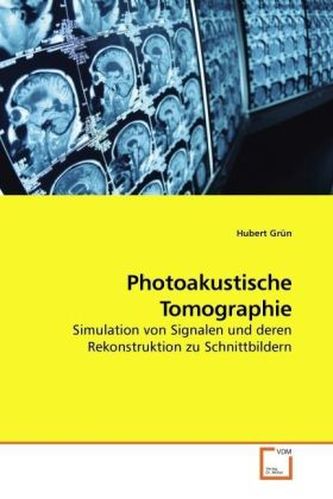 Photoakustische Tomographie