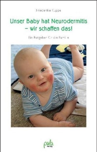Unser Baby hat Neurodermitis - wir schaffen das!