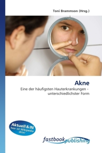 Akne