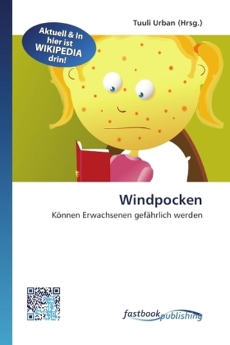 Windpocken