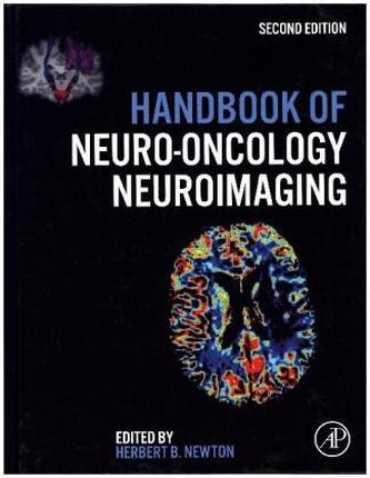 Handbook of Neuro-Oncology Neuroimaging