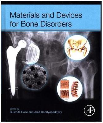 Materials and Devices for Bone Disorders