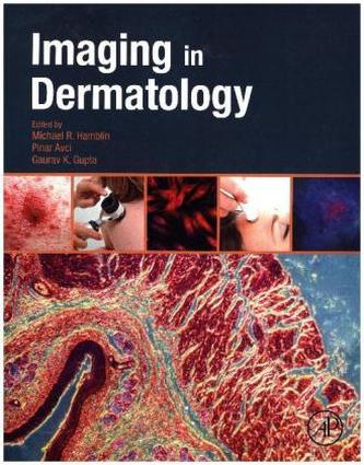 Imaging in Dermatology