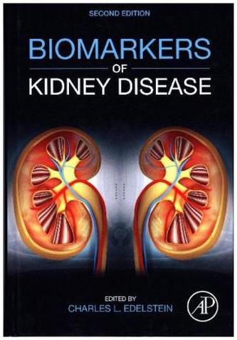 Biomarkers of Kidney Disease