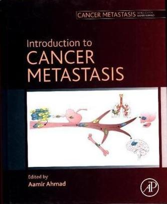 Introduction to Cancer Metastasis