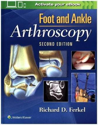 Foot & Ankle Arthroscopy, 2 Vols.