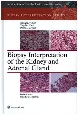 Biopsy Interpretation of the Kidney & Adrenal Gland