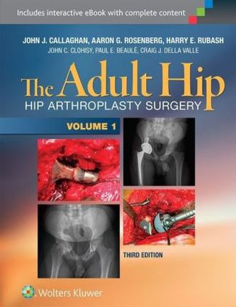 The Adult Hip, 2 Vols.