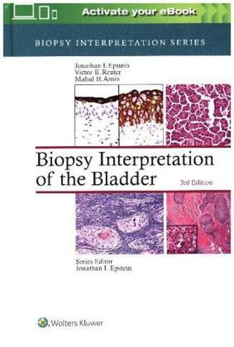 Biopsy Interpretation of the Bladder, 3 Vols.