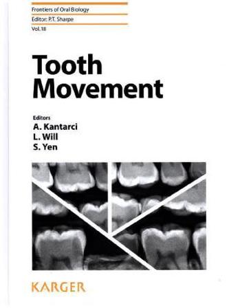 Tooth Movement