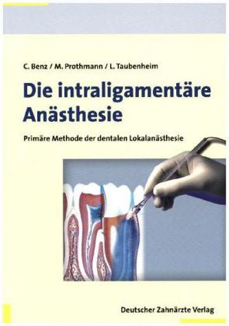Die intraligamentäre Anästhesie