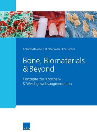 Bone, Biomaterials & Beyond