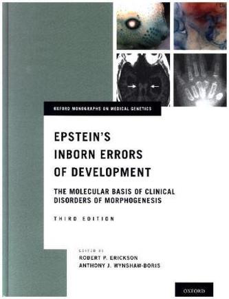Epstein's Inborn Errors of Development