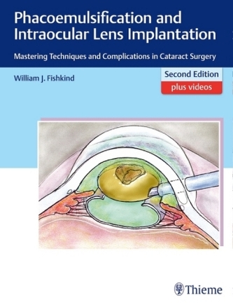Phacoemulsification and Intraocular Lens Implantation Phacoemulsification and Intraocular Lens Implantation
