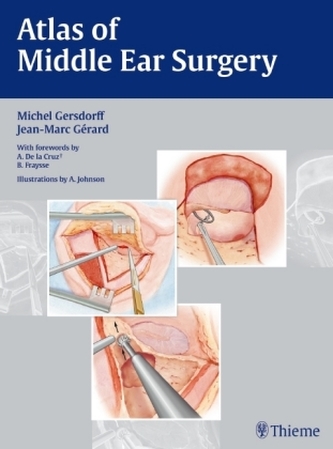 Atlas of Middle Ear Surgery